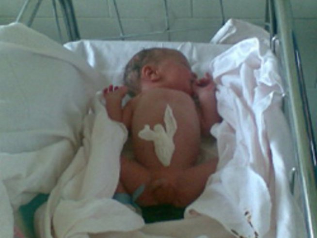 Как да преодолеем страха от раждането