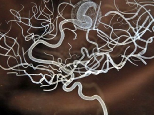 Как да изгоним от главата си досадните мисли?