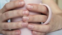 Какво означава, ако имате ивици по ноктите?